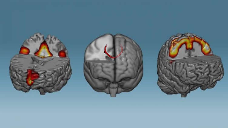 Brain Change Image